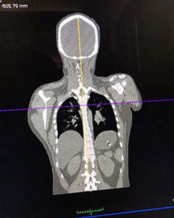Three-Dimensional Scan and CT Scan