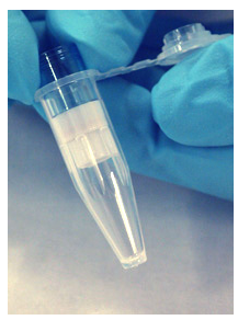 Photo of centrifugal filter unit