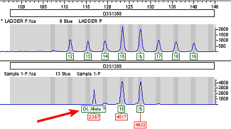 Microvariants and OL Alleles