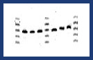 Electrophoresis Smile Bands