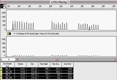 Difference in ladder peak height using formamide with low conductivity (upper electropheragram) and data using formamide with high conductivity (lower electropheragram)