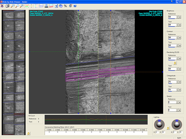 Consecutive matching stria defined in color in an on-screen comparison