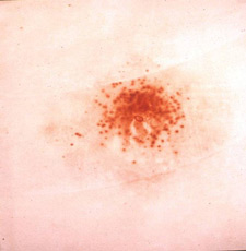 Modified Griess Test results at 3 inches