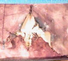 Contact shot with tearingof the material and soot around the entrance hole.