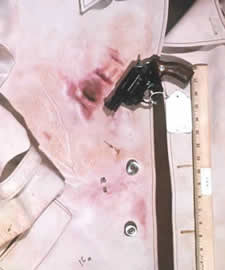 Blue-violet positive result for the Sodium Rhodizonate Test for lead with the evidence revolver, showing cylinder blast and muzzle blast