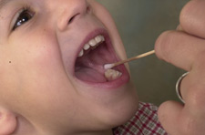 Photo of a child getting their mouth swabbed