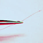 The end of a hair follicle