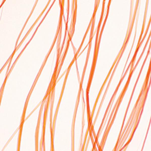 Optical microscope image of nylon fibers. The identification of different types of fibers is critical to investigating a crime scene. The magnification is 200 times when printed 10 inches wide.
